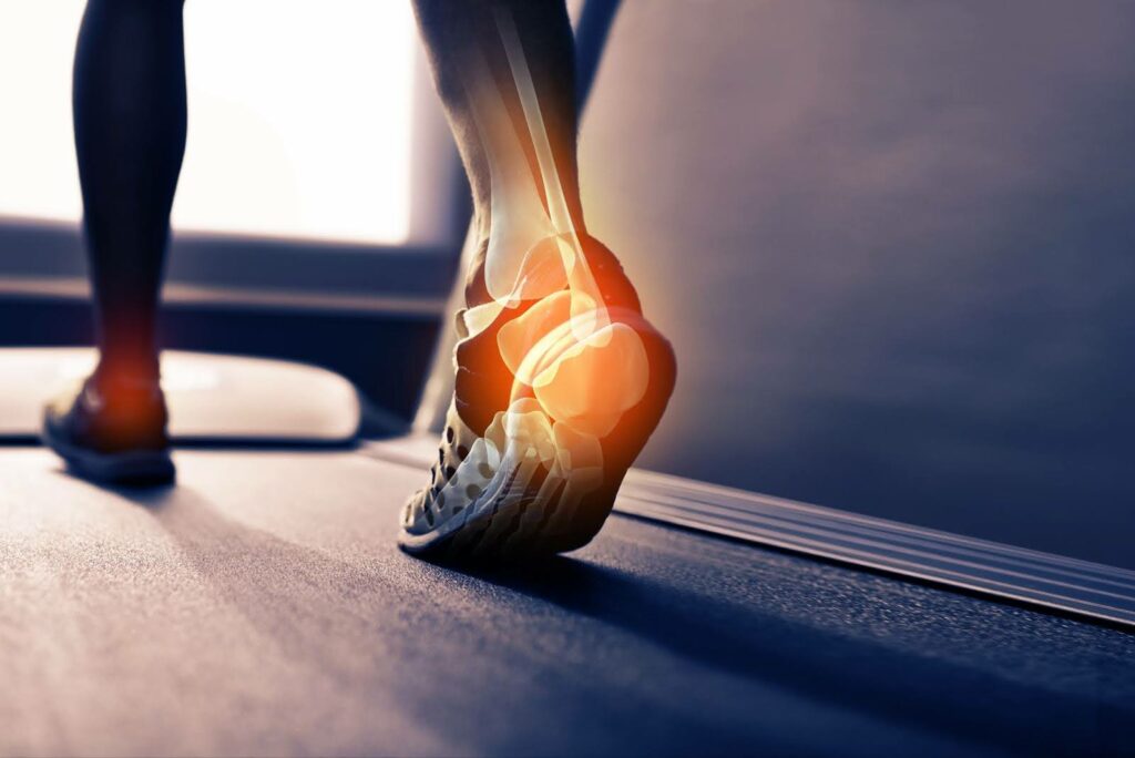 Image montrant les pieds d'un sportif et ses os en transparence sur un tapis de course.